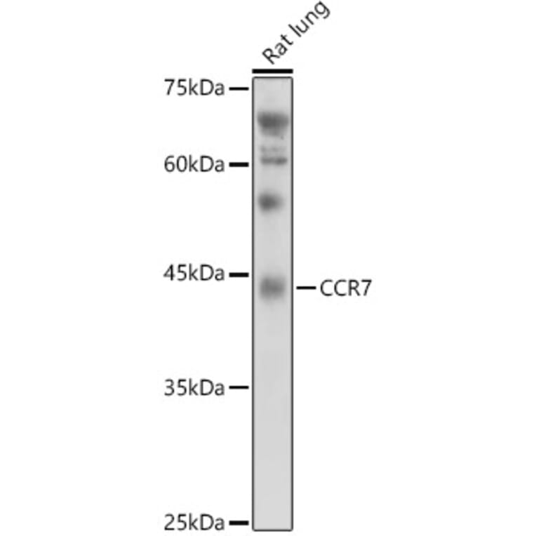Western Blot - Anti-CCR7 Antibody (A89932) - Antibodies.com