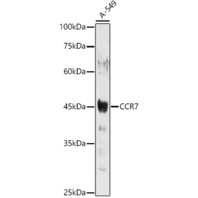 Western Blot - Anti-CCR7 Antibody (A89932) - Antibodies.com