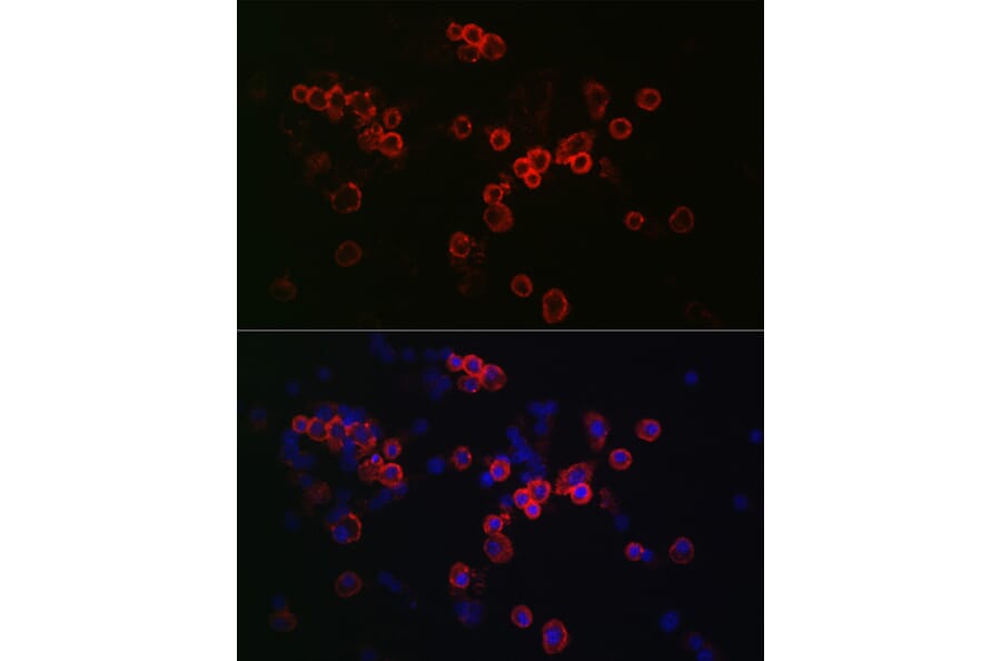 Immunofluorescence - Anti-CCR7 Antibody (A89932)