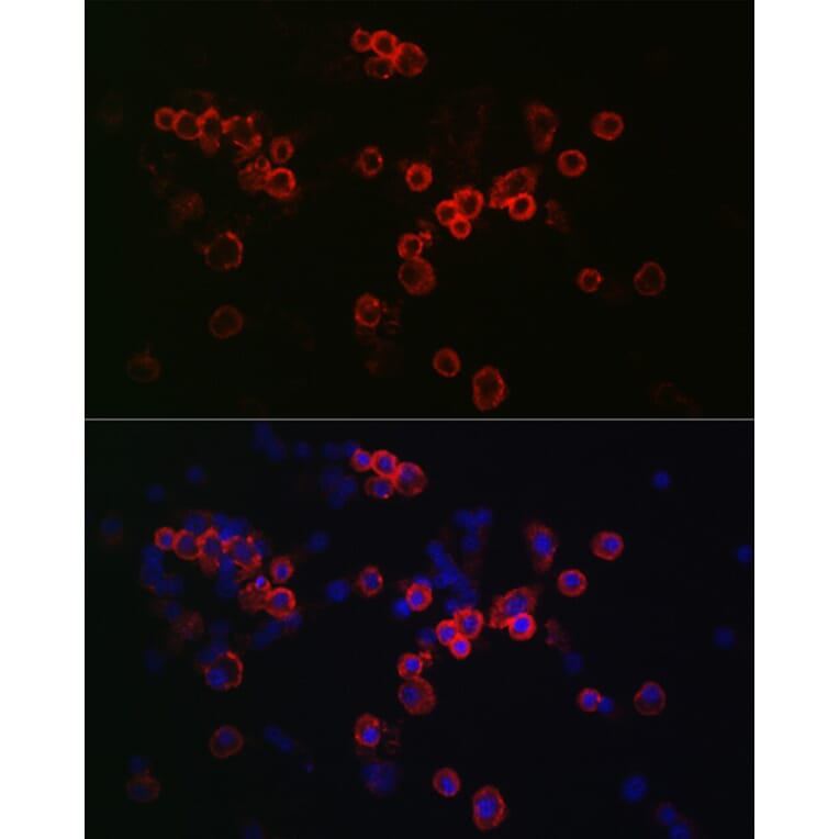 Immunofluorescence - Anti-CCR7 Antibody (A89932) - Antibodies.com