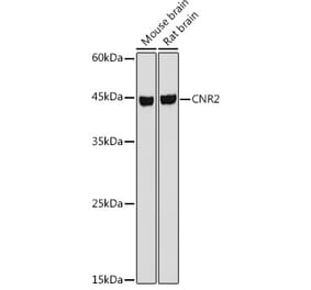 Western Blot - Anti-Cannabinoid Receptor II Antibody (A89933) - Antibodies.com
