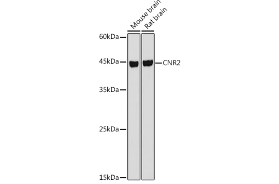 Western Blot - Anti-Cannabinoid Receptor II Antibody (A89933) - Antibodies.com