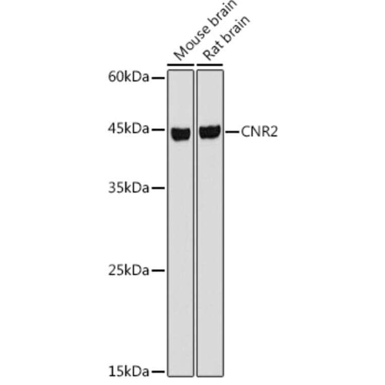 Western Blot - Anti-Cannabinoid Receptor II Antibody (A89933) - Antibodies.com