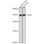 Western Blot - Anti-Cannabinoid Receptor II Antibody (A89933) - Antibodies.com