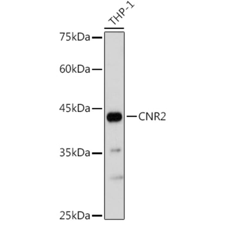 Western Blot - Anti-Cannabinoid Receptor II Antibody (A89933) - Antibodies.com