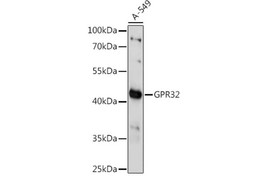 Western Blot - Anti-GPCR GPR32 Antibody (A89934) - Antibodies.com