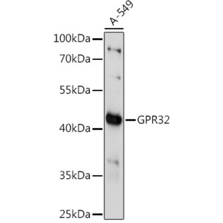 Western Blot - Anti-GPCR GPR32 Antibody (A89934) - Antibodies.com