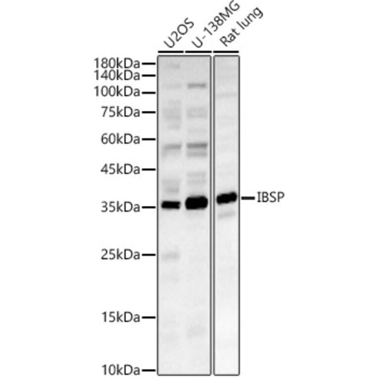 Western Blot - Anti-Bone Sialoprotein Antibody (A89935) - Antibodies.com