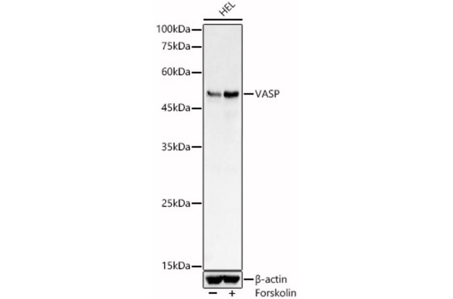 Western Blot - Anti-VASP Antibody (A89936) - Antibodies.com