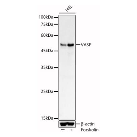 Western Blot - Anti-VASP Antibody (A89936) - Antibodies.com