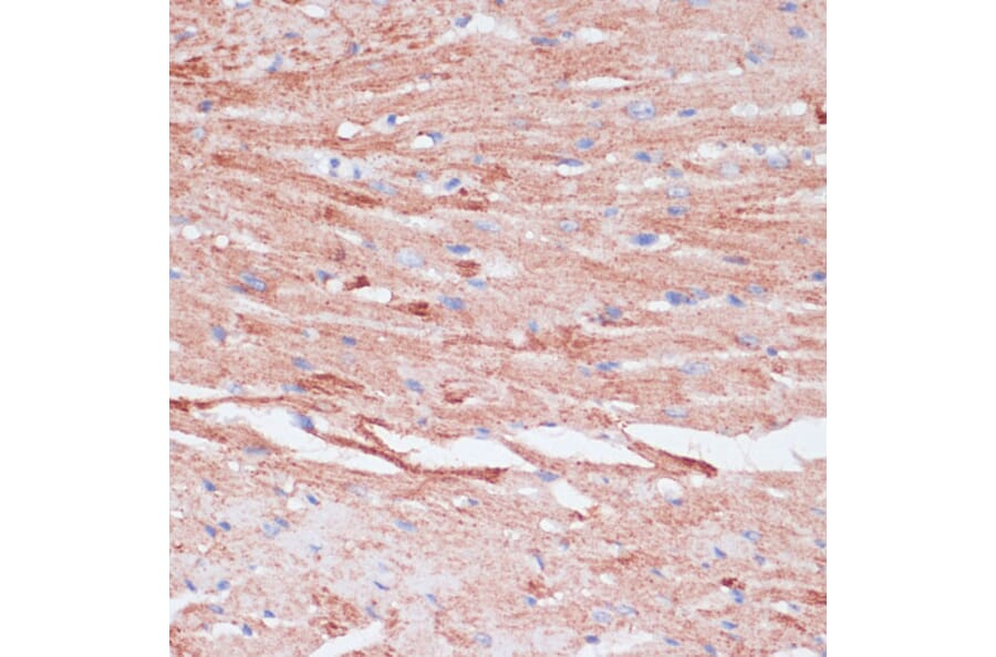Immunohistochemistry - Anti-VASP Antibody (A89936) - Antibodies.com