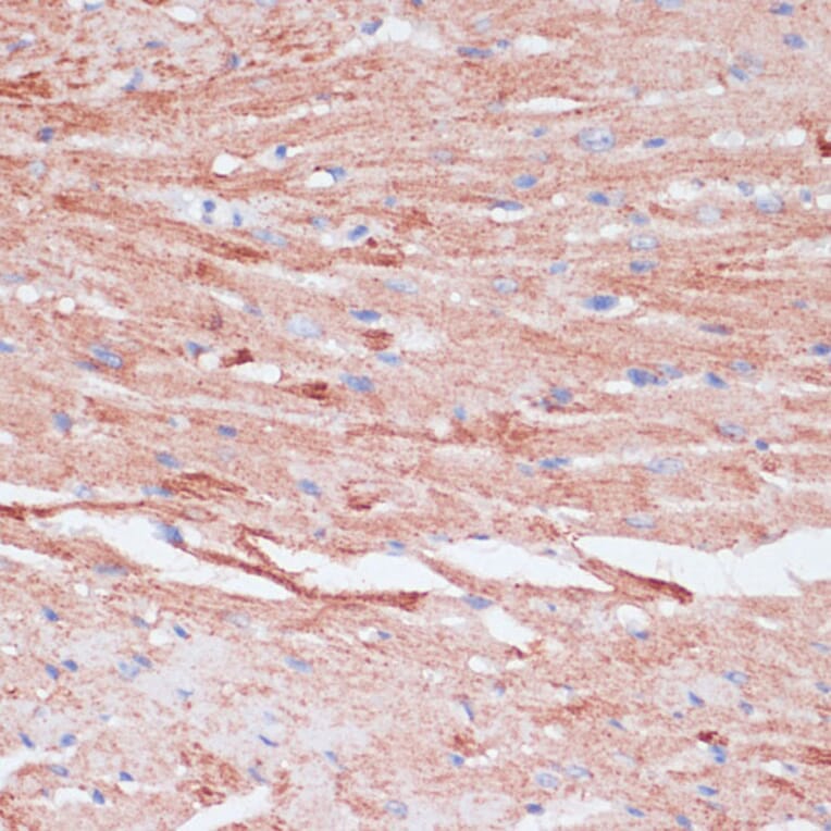 Immunohistochemistry - Anti-VASP Antibody (A89936) - Antibodies.com