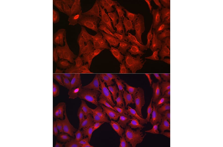 Immunofluorescence - Anti-VASP Antibody (A89936) - Antibodies.com
