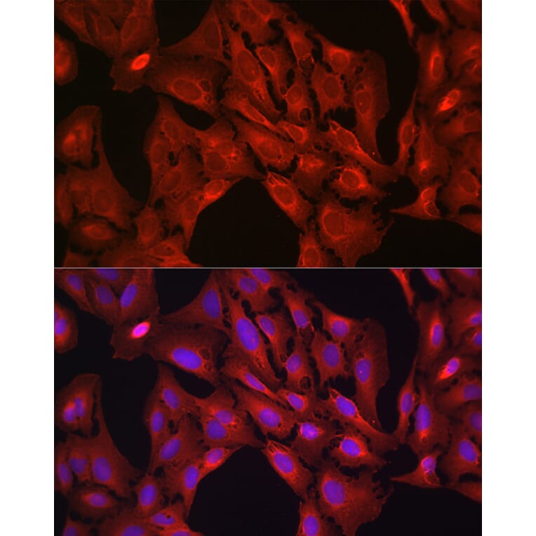 Immunofluorescence - Anti-VASP Antibody (A89936) - Antibodies.com