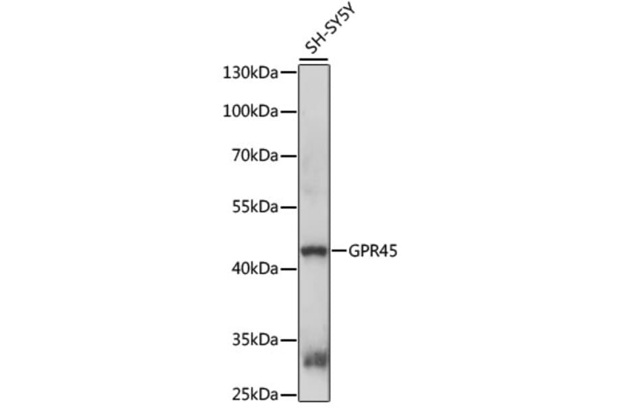 Western Blot - Anti-GPR45 Antibody (A89937) - Antibodies.com