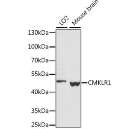 Western Blot - Anti-CMKLR1 Antibody (A89938) - Antibodies.com