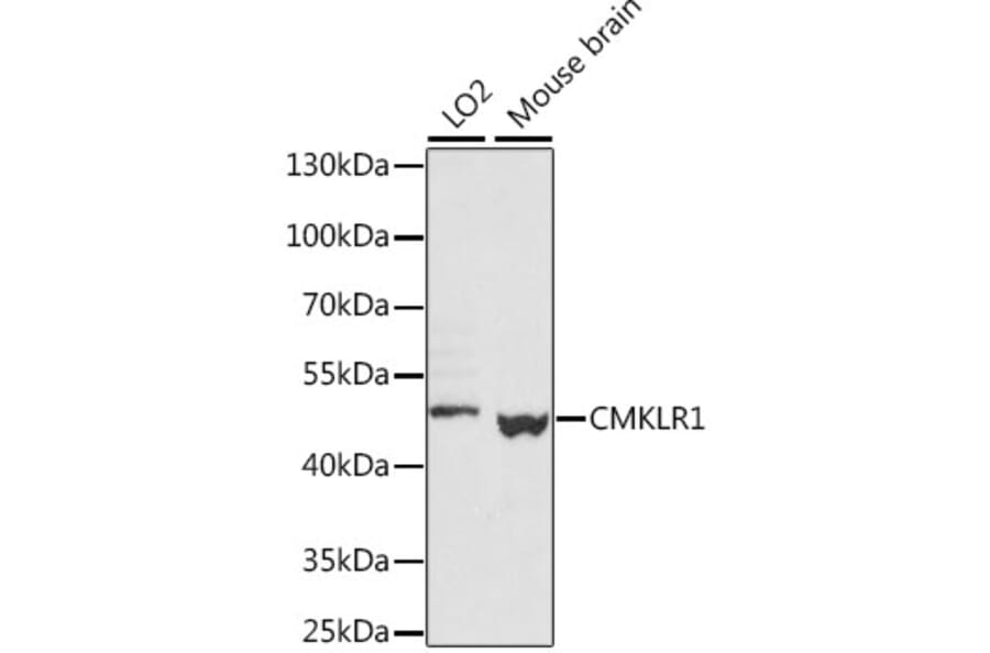 Western Blot - Anti-CMKLR1 Antibody (A89938) - Antibodies.com