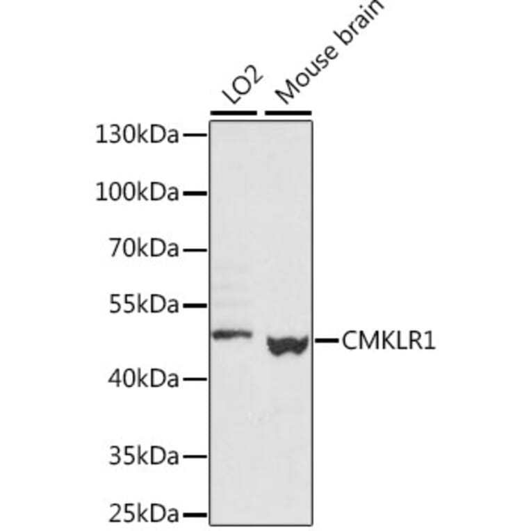 Western Blot - Anti-CMKLR1 Antibody (A89938) - Antibodies.com