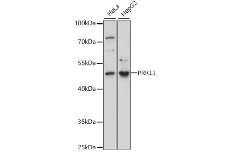 Western Blot - Anti-PRR11 Antibody (A15599) - Antibodies.com