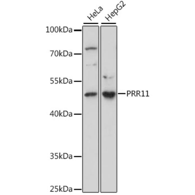 Western Blot - Anti-PRR11 Antibody (A15599) - Antibodies.com