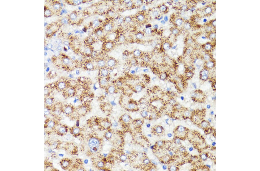 Immunohistochemistry - Anti-PRR11 Antibody (A15599) - Antibodies.com