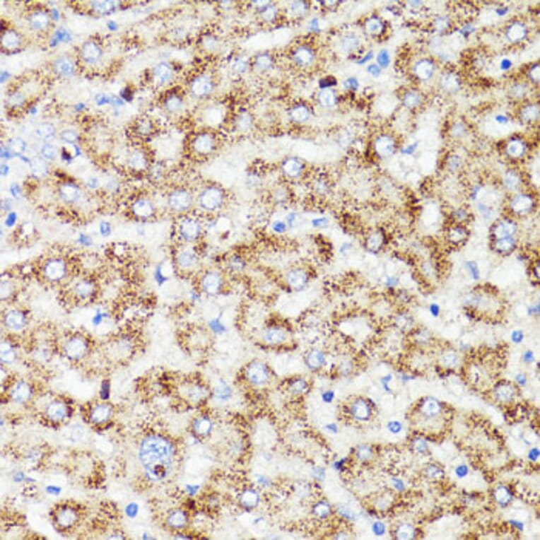 Immunohistochemistry - Anti-PRR11 Antibody (A15599) - Antibodies.com