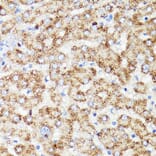 Immunohistochemistry - Anti-PRR11 Antibody (A15599) - Antibodies.com