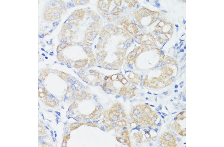 Immunohistochemistry - Anti-PRR11 Antibody (A15599) - Antibodies.com
