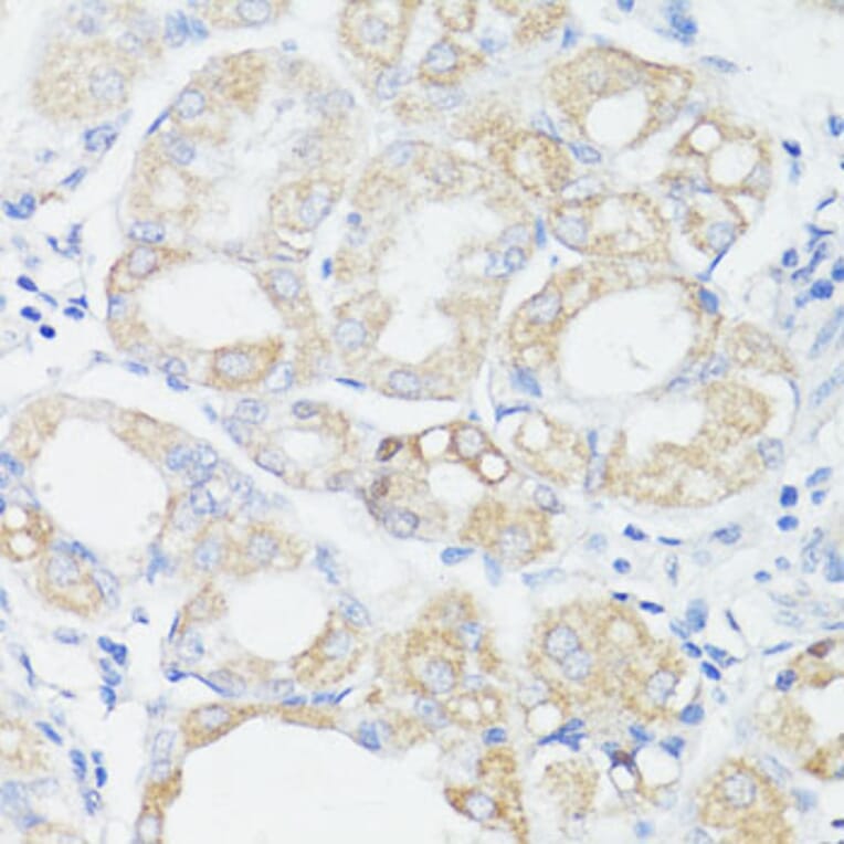 Immunohistochemistry - Anti-PRR11 Antibody (A15599) - Antibodies.com