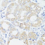 Immunohistochemistry - Anti-PRR11 Antibody (A15599) - Antibodies.com