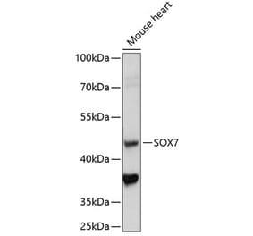 Western Blot - Anti-SOX7 Antibody (A89940) - Antibodies.com