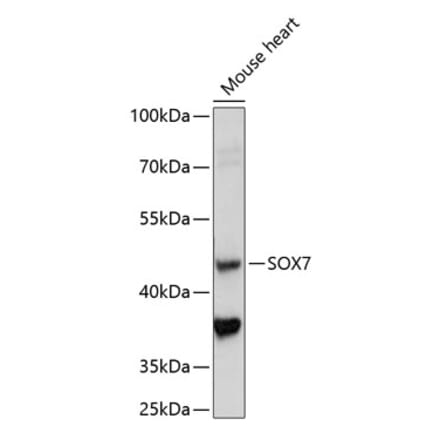 Western Blot - Anti-SOX7 Antibody (A89940) - Antibodies.com