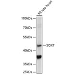 Western Blot - Anti-SOX7 Antibody (A89940) - Antibodies.com