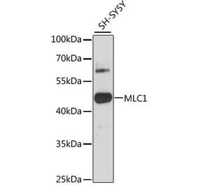 Western Blot - Anti-MLC1 Antibody (A89941) - Antibodies.com