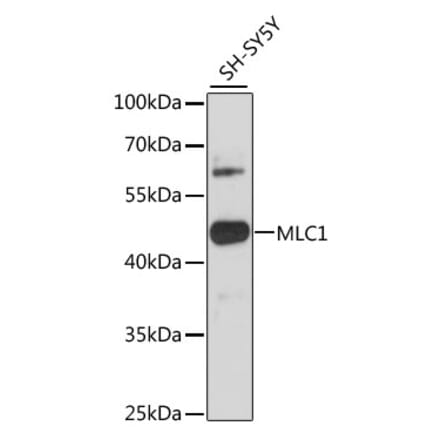 Western Blot - Anti-MLC1 Antibody (A89941) - Antibodies.com
