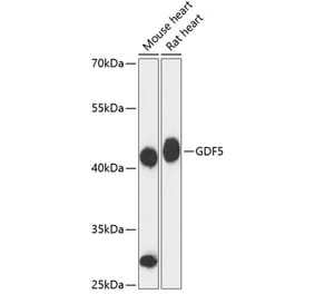 Western Blot - Anti-GDF 5 Antibody (A89942) - Antibodies.com