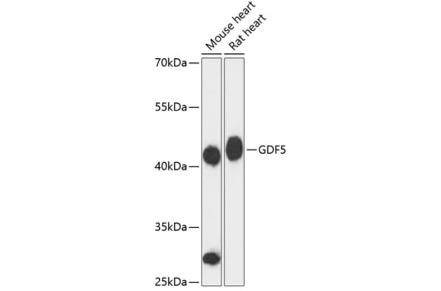 Western Blot - Anti-GDF 5 Antibody (A89942) - Antibodies.com