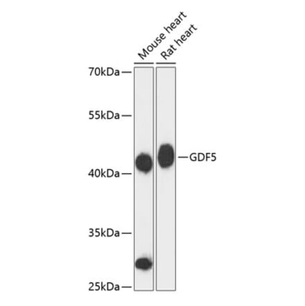 Western Blot - Anti-GDF 5 Antibody (A89942) - Antibodies.com