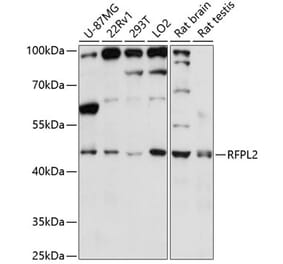 Western Blot - Anti-RFPL2 Antibody (A89943) - Antibodies.com