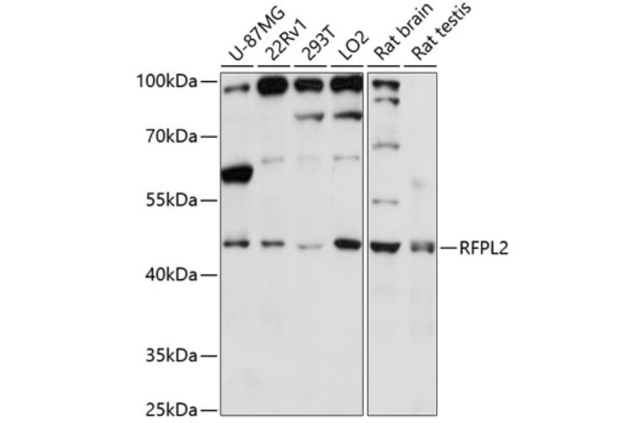 Western Blot - Anti-RFPL2 Antibody (A89943) - Antibodies.com
