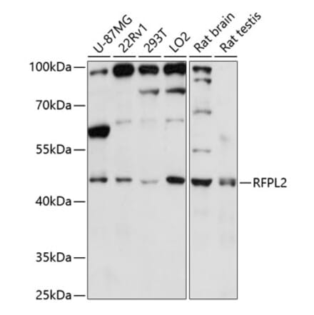 Western Blot - Anti-RFPL2 Antibody (A89943) - Antibodies.com