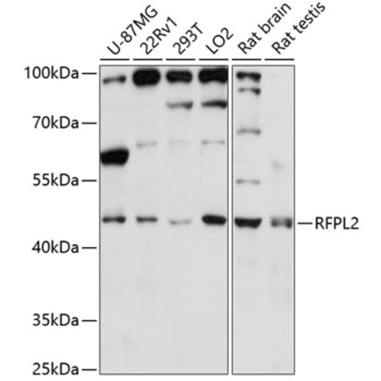 Western Blot - Anti-RFPL2 Antibody (A89943) - Antibodies.com