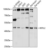 Western Blot - Anti-RFPL2 Antibody (A89943) - Antibodies.com