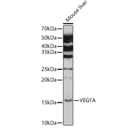 Western Blot - Anti-VEGFA Antibody (A89945) - Antibodies.com