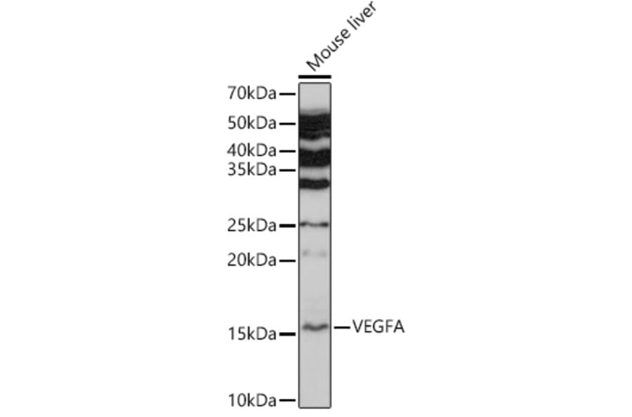 Western Blot - Anti-VEGFA Antibody (A89945) - Antibodies.com