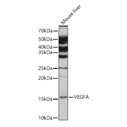 Western Blot - Anti-VEGFA Antibody (A89945) - Antibodies.com