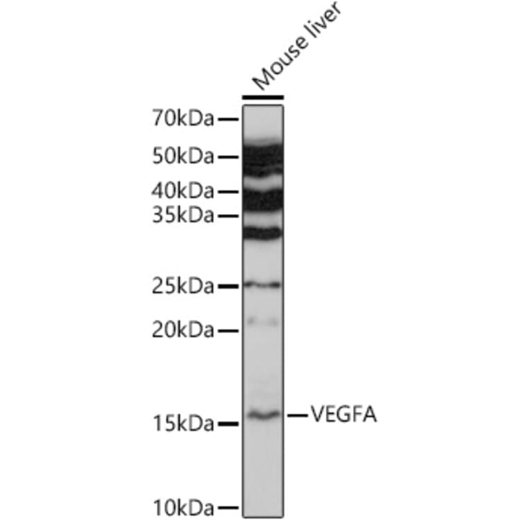 Western Blot - Anti-VEGFA Antibody (A89945) - Antibodies.com