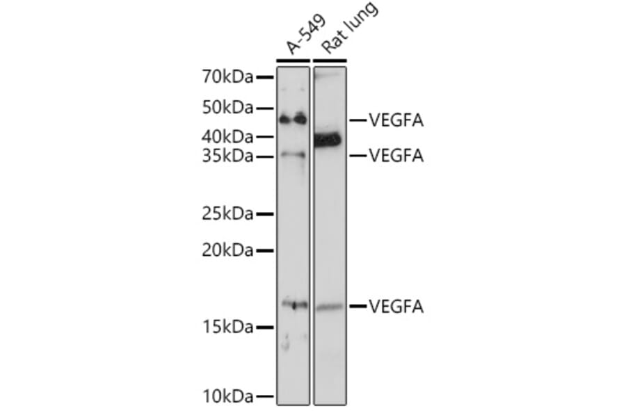 Western Blot - Anti-VEGFA Antibody (A89945) - Antibodies.com