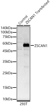 Western blot analysis of extracts of HepG2 cells, using Anti-ZSCAN1 Antibody (A16639) at 1:1,000 dilution.
Secondary antibody: Goat Anti-Rabbit IgG (H+L) (HRP) (AS014) at 1:10,000 dilution.
Lysates / proteins: 25µg per lane.
Blocking buffer: 3% non-fat dry milk in TBST.
Detection: ECL Enhanced Kit (RM00021).
Exposure time: 90s.