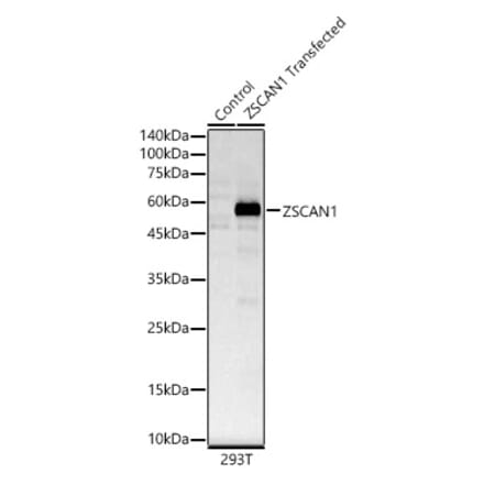 Western Blot - Anti-ZSCAN1 Antibody (A89946) - Antibodies.com